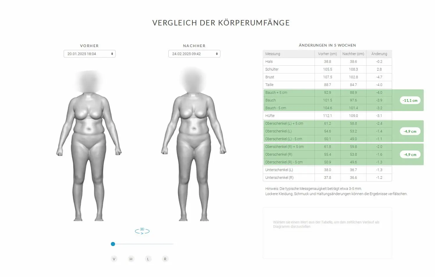 Anonymisierter SCANECA-Vergleich der Körperumfänge nach zehn MYA-Pro-Anwendungen